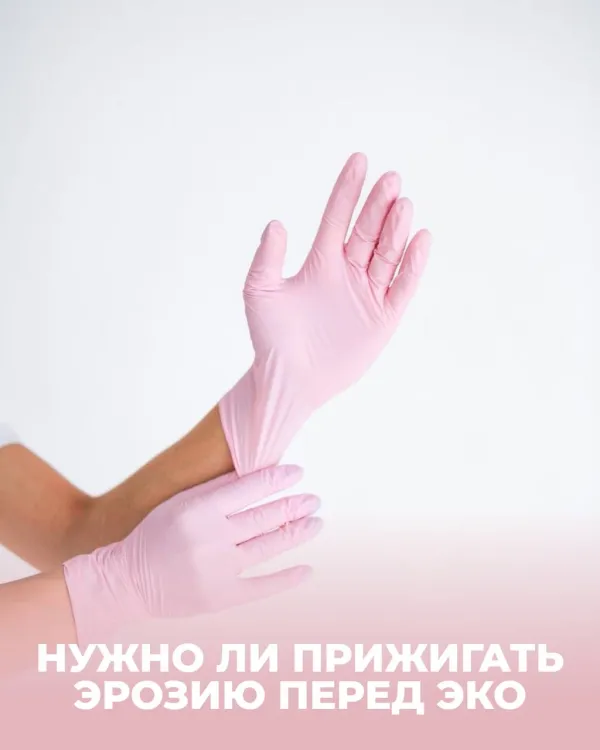 Нужно ли прижигать эрозию перед ЭКО?