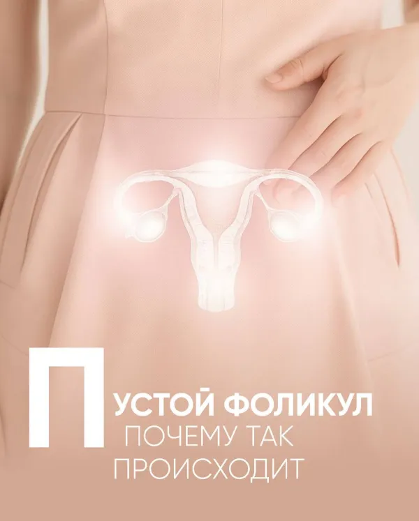 Пустой фолликул: почему так происходит?