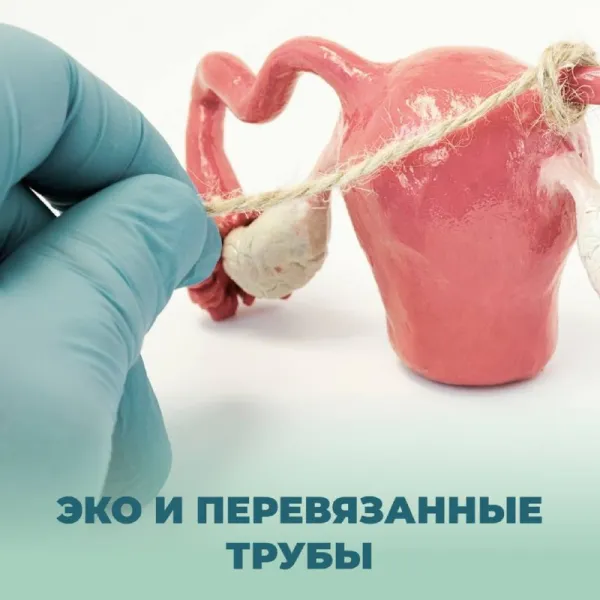 Когда передумали: ЭКО после перевязки маточных труб